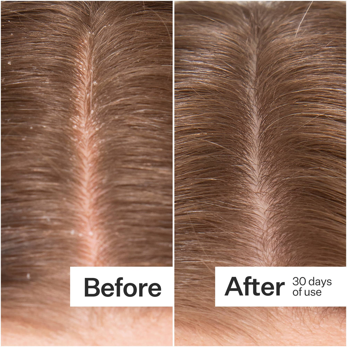 Microbiome Cooling Scalp Serum